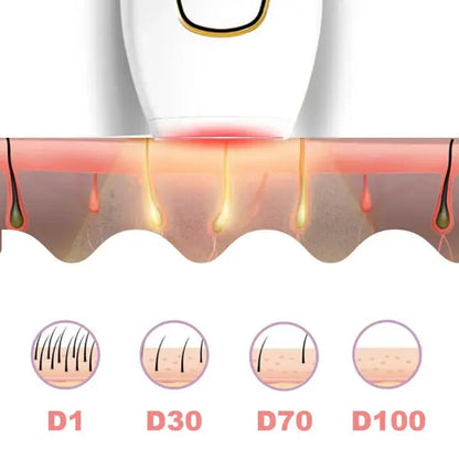 SilkPulse Pro – Portable IPL Hair Remover