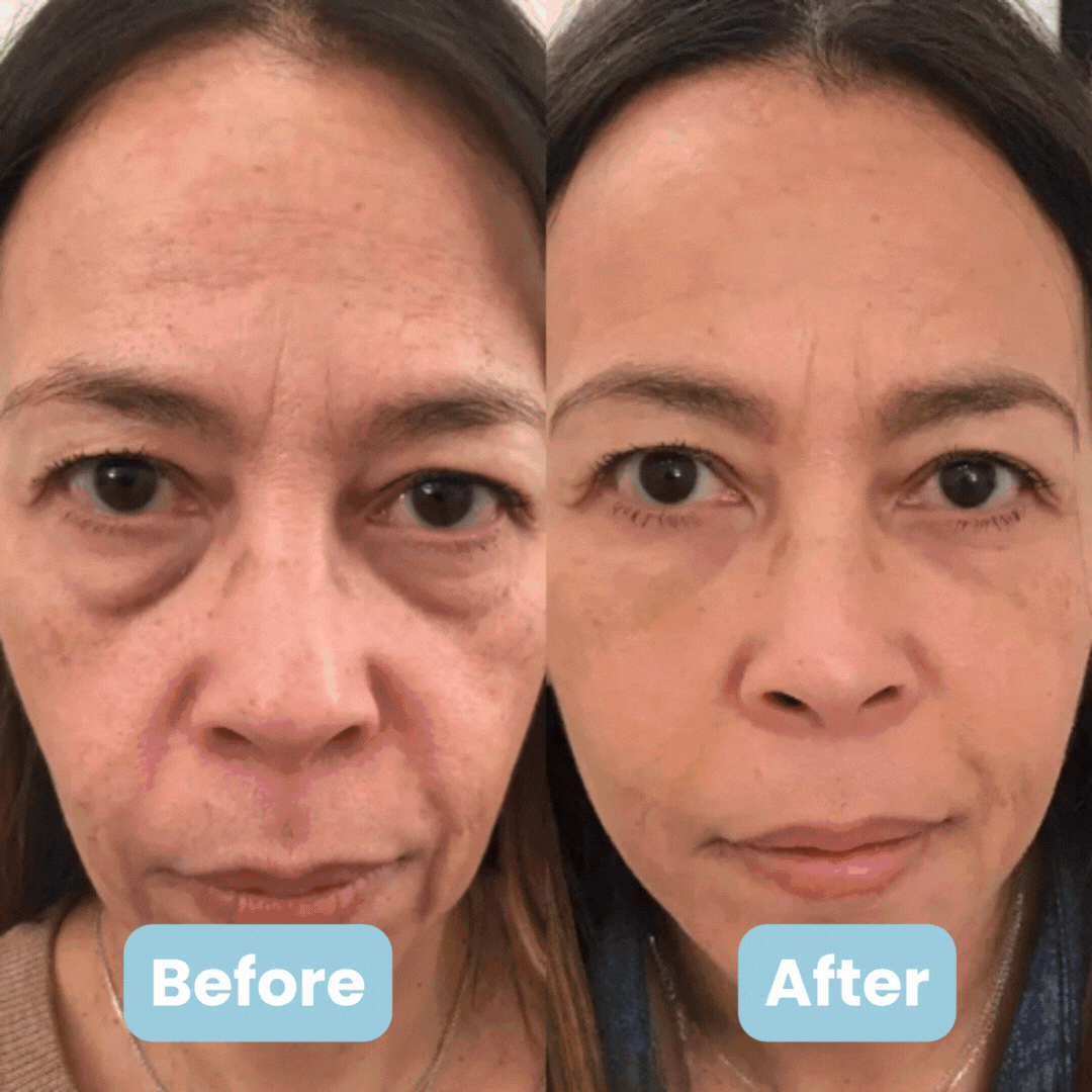 LED Facial Sculptor with Phototherapy Anti-Wrinkle Effect - GlowUp
