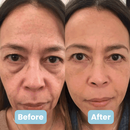 LED Facial Sculptor with Phototherapy Anti-Wrinkle Effect - GlowUp