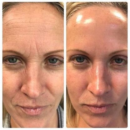 Facial Massager with Phototherapy Anti-Wrinkle Effect - GlowUp
