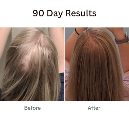AuraBrush™ – The Natural 4‑in‑1 Hair Restoring Brush