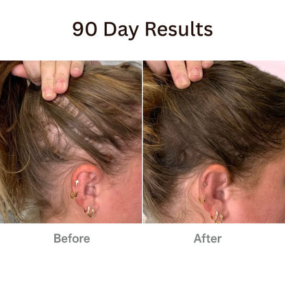 AuraBrush™ – The Natural 4‑in‑1 Hair Restoring Brush