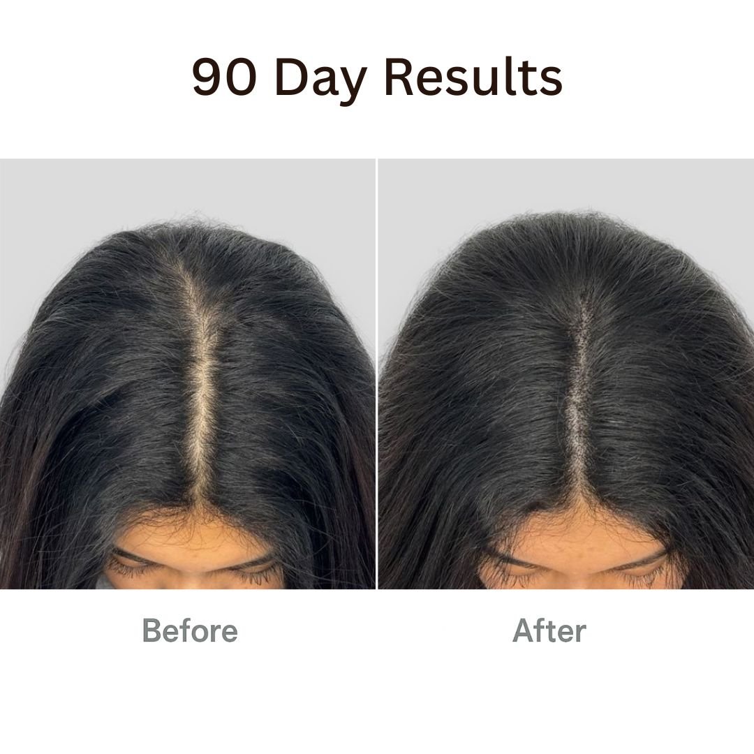 AuraBrush™ – The Natural 4‑in‑1 Hair Restoring Brush