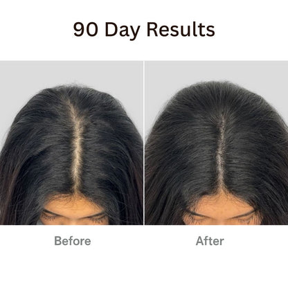 AuraBrush™ – The Natural 4‑in‑1 Hair Restoring Brush